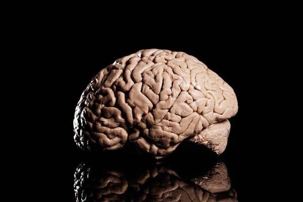 Total Ada 600 Otak Manusia di Brain Museum, Ini 8 Fakta Uniknya!