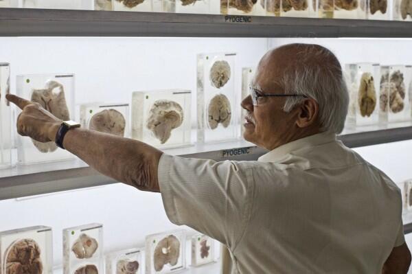 Total Ada 600 Otak Manusia di Brain Museum, Ini 8 Fakta Uniknya!