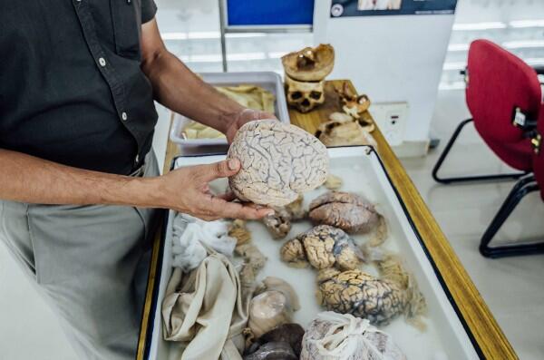Total Ada 600 Otak Manusia di Brain Museum, Ini 8 Fakta Uniknya!