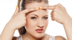 5 Fakta Bawang Putih Bikin Cantik Wanita Indonesia