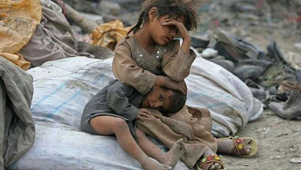 Akibat Perang di Yaman, 85 Ribu Anak Meninggal Karena Malnutrisi