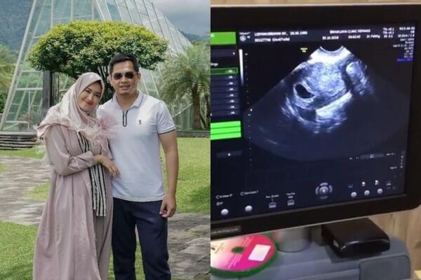 Bakal Punya Anak Lagi, 10 Potret Kemesraan Tommy Kurniawan & Istri