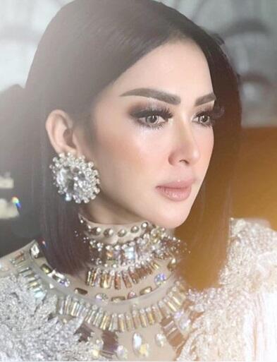 Perubahan Wajah Syahrinih yang Makin Cetar, Percaya Nggak Kalau Nggak Oplas?