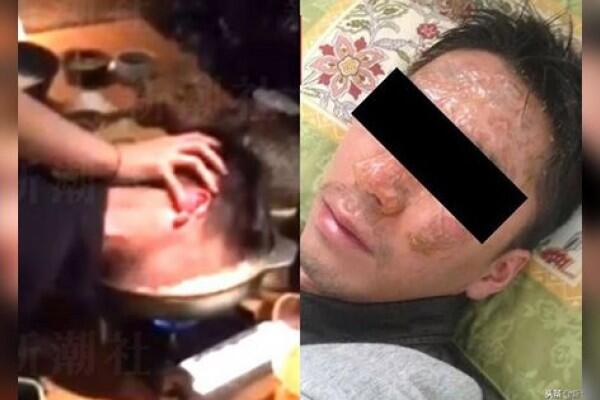 Pria Jepang Gugat Bos Setelah Kepalanya Dicelup ke Kuah Sup Mendidih
