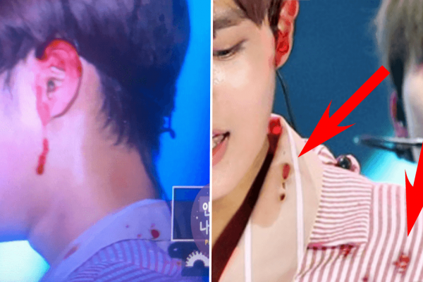 Profesional, 8 Idol KPop Ini Tetap Menari di Panggung Meski Cedera