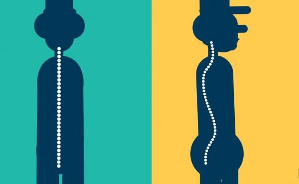 Ini 10 Alasan Penting Menjaga Postur Tubuhmu, Bukan Hanya Omelan Ortu!