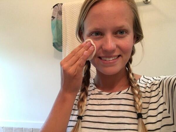 Skincare 101: Benzoyl Peroxide vs. Salicylic Acid, Bagusan yang Mana?