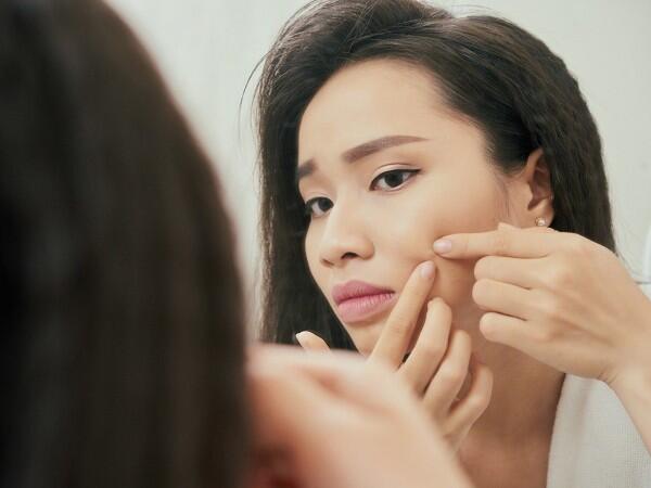 6 Hal yang Gak Boleh Dilakukan di Wajahmu Menurut Para Dermatologist