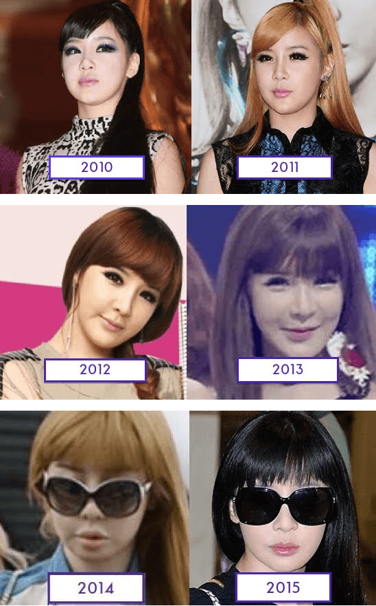 AKIBAT OPLAS! Park Bom,Ex Girlband KOREA,Makin Tua Jadi Makin CANTIK?