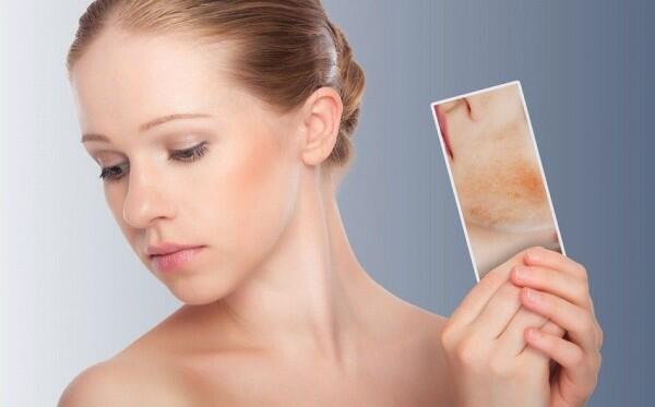 8 Alasan Kenapa Kamu Butuh Skincare Berbahan Niacinamide