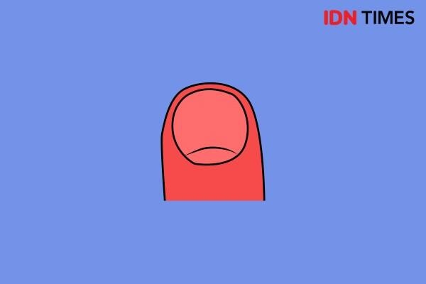 8 Bentuk Kuku Ini Gambarkan Sifatmu Lho! Kalau Punyamu Artinya Apa Ya?