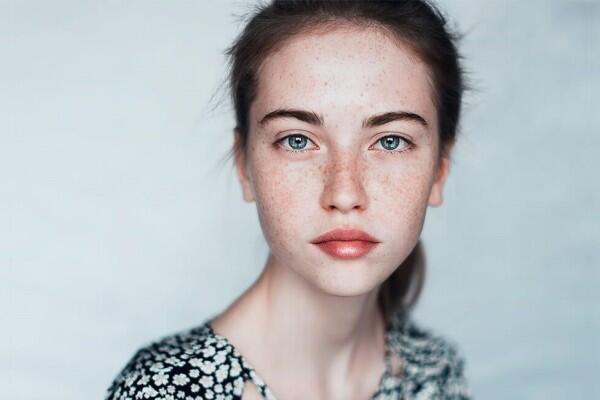 5 Beda Sun Spot vs. Dark Spot yang Harus Kamu Tahu, Jangan Ditukar Ya!
