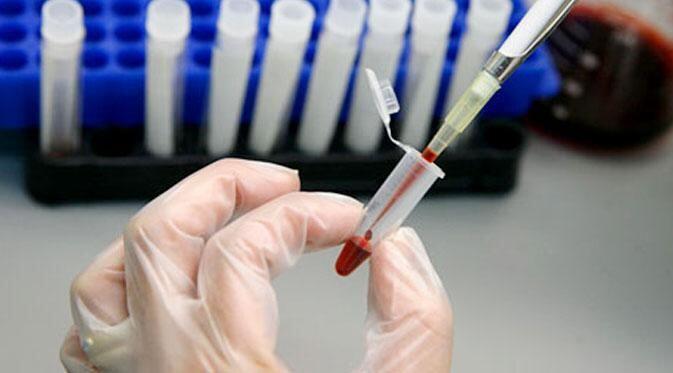 11 Mitos dan Fakta Tentang AIDS yang Harusnya Semua Orang Pahami