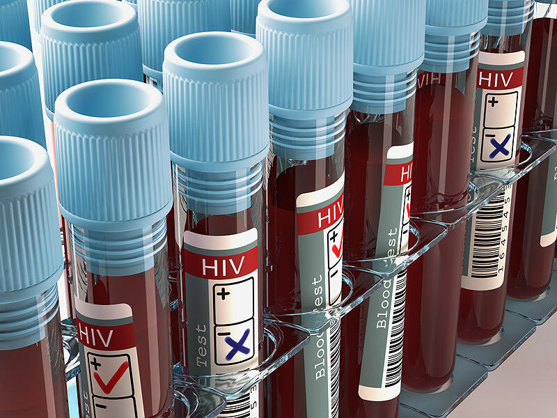 Orang US Ini Tercatat Sebagai Satu-satunya Pasien Sembuh dari HIV-AIDS