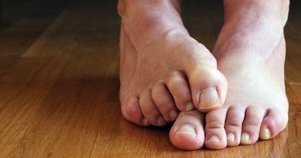 Jangan Anggap Remeh, 10 Penyakit ini Muncul Pada Musim Penghujan