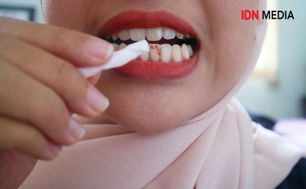 8 Beauty Hack Super Gampang Ampuh untuk Memperbaiki Kesalahan Makeup