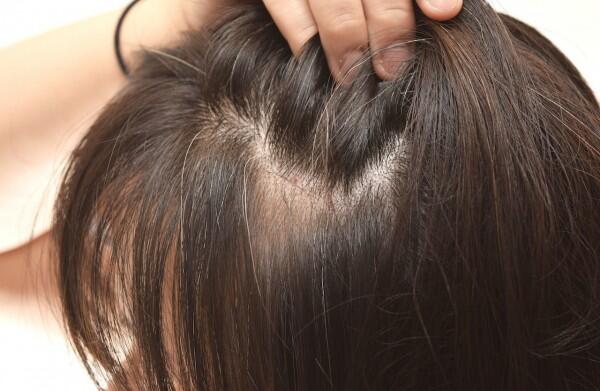 Masih Muda, Rambut Memutih? Ini 10 Fakta Mencengangkan Tentang Uban