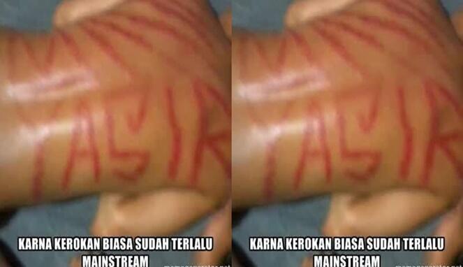 7 Motif Kerokan Ini Artistik Banget Dijamin Bikin Melongo