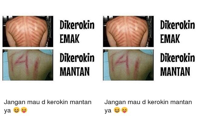 7 Motif Kerokan Ini Artistik Banget Dijamin Bikin Melongo