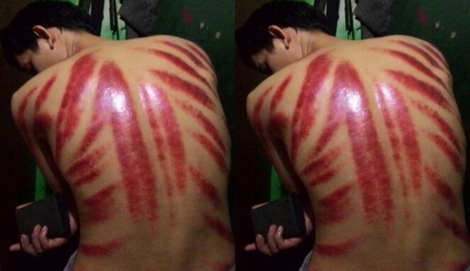 7 Motif Kerokan Ini Artistik Banget Dijamin Bikin Melongo
