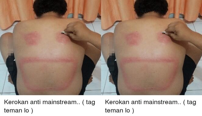 7 Motif Kerokan Ini Artistik Banget Dijamin Bikin Melongo