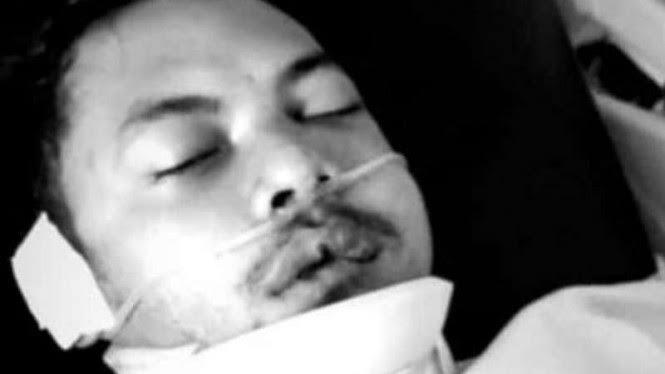 Pemain PS Mojokerto Putra, Krisna Adi, Alami Kecelakaan