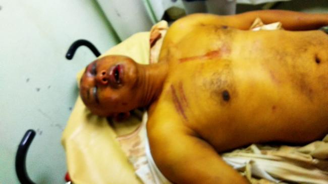 Seorang Pria di Batam Nyaris Tewas Disekap dan Dianiaya Sekelompok Orang