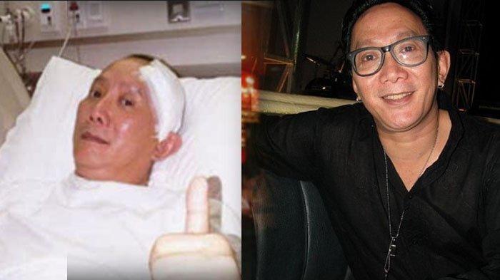 Innalillahi, Aktor Robby Tumewu Meninggal Dunia