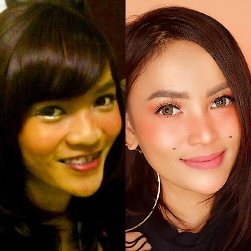 9 Artis yang Jadi Korban #10YearsChallenge, Ada Nama Raditya Dika Hingga Marion Jola