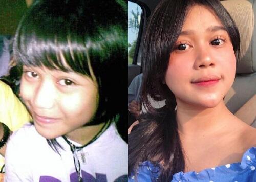 9 Artis yang Jadi Korban #10YearsChallenge, Ada Nama Raditya Dika Hingga Marion Jola