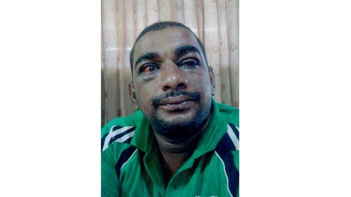 Melapor ke Polisi Malah Ditahan, Ini Penjelasan Polsek Medan Baru terkait Kasus Rakes