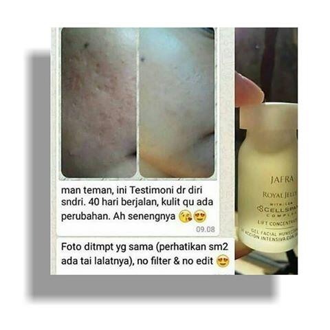CARA Sehat Usir Jerawat😉. Ngaskus Sambil Bisnis