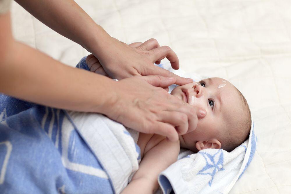 Penyebab Eksim Pada Kulit Bayi, dan Cara Mengatasinya