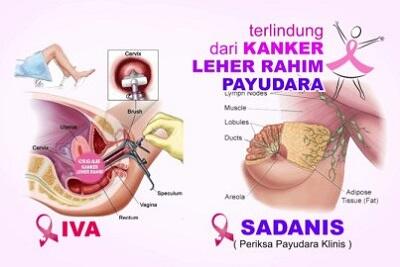 Hati-Hati Sis! Kanker Payudara &amp; Kanker Serviks Menjadi Momok Terbesar di Indonesia!