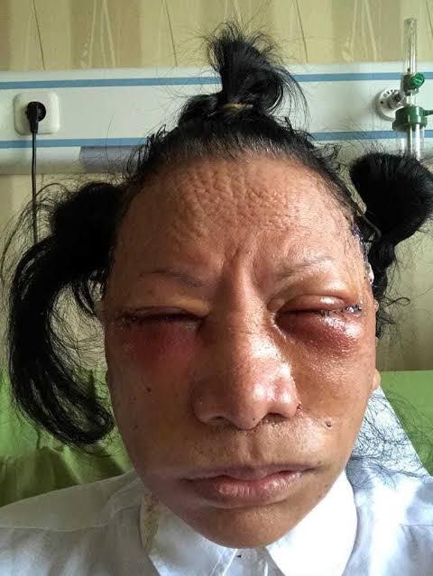 Ratna Didakwa Bikin Onar, BPN: Cepat Kelar, Jangan Digoreng Terus
