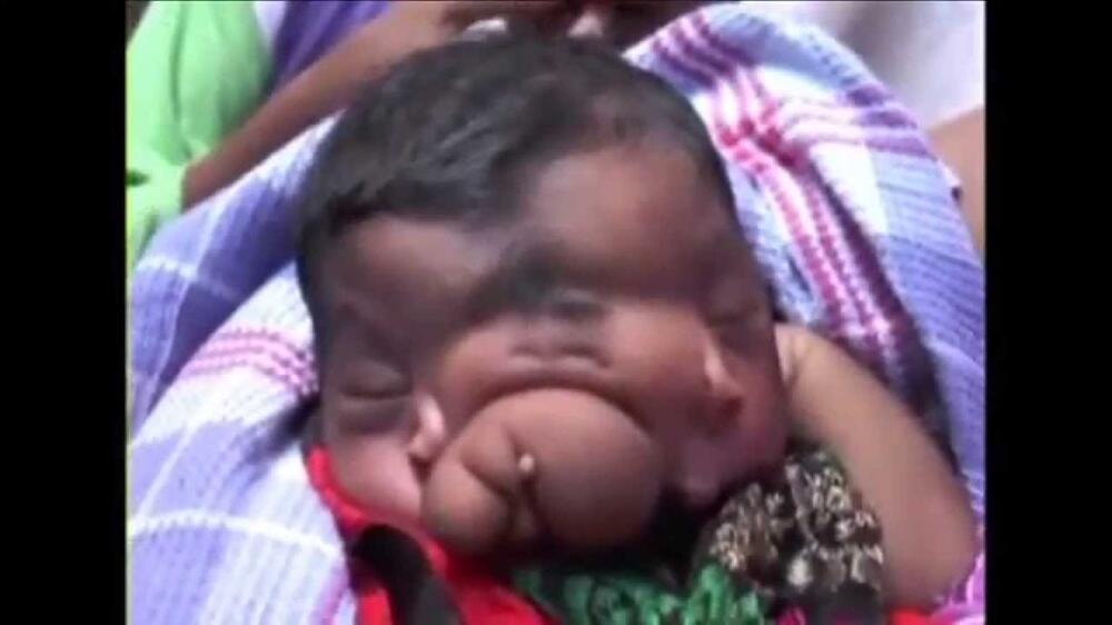 Melihat Anak-Anak Ini Apakah Kalian Merasa Takut Atau Kasihan?
