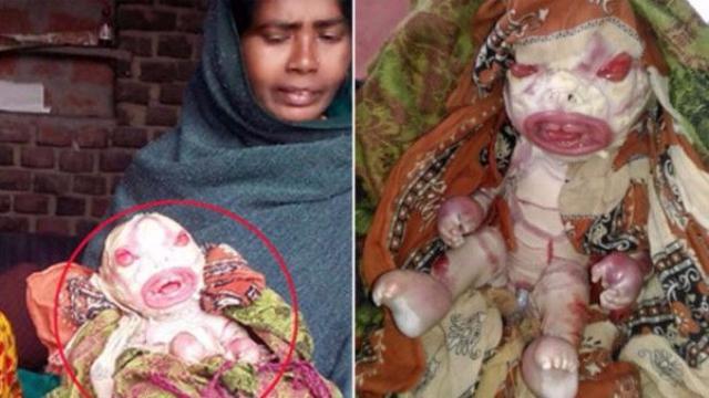 Melihat Anak-Anak Ini Apakah Kalian Merasa Takut Atau Kasihan?
