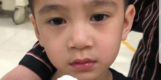 Terjepit Pintu, Kuku Tangan Rafathar Lepas