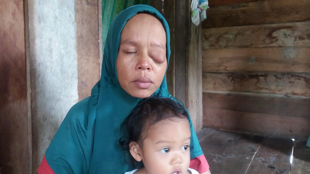 Surat Terbuka Untuk Pemda Kabupaten Kepulauan Meranti