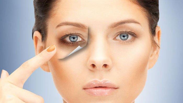 Bermasalah dengan Mata Panda, Ini 8 Bahan Alami untuk Hilangkan Kantung Mata