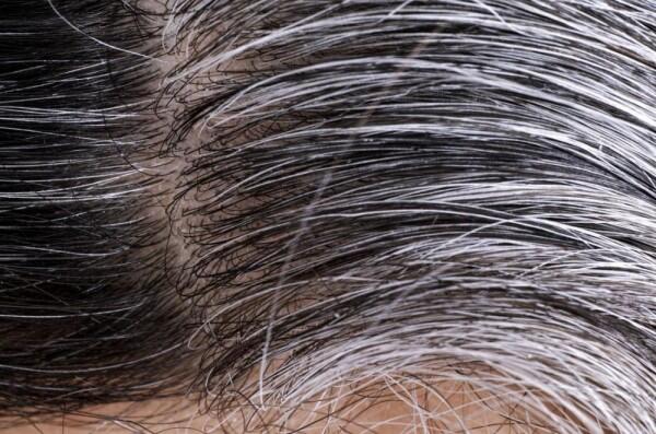 5 Manfaat Hebat Minyak Wijen untuk Rambut, Sudah Pernah Coba?