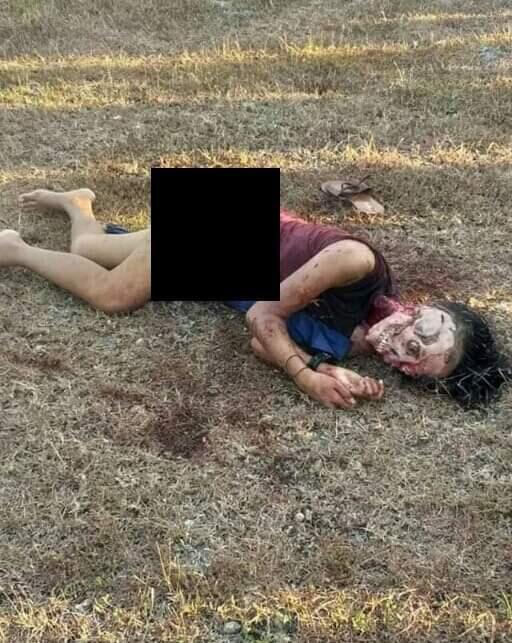 Sadis! Usai Diperkosa Gadis Ini Dibunuh, Sebagian Wajahnya Dikuliti