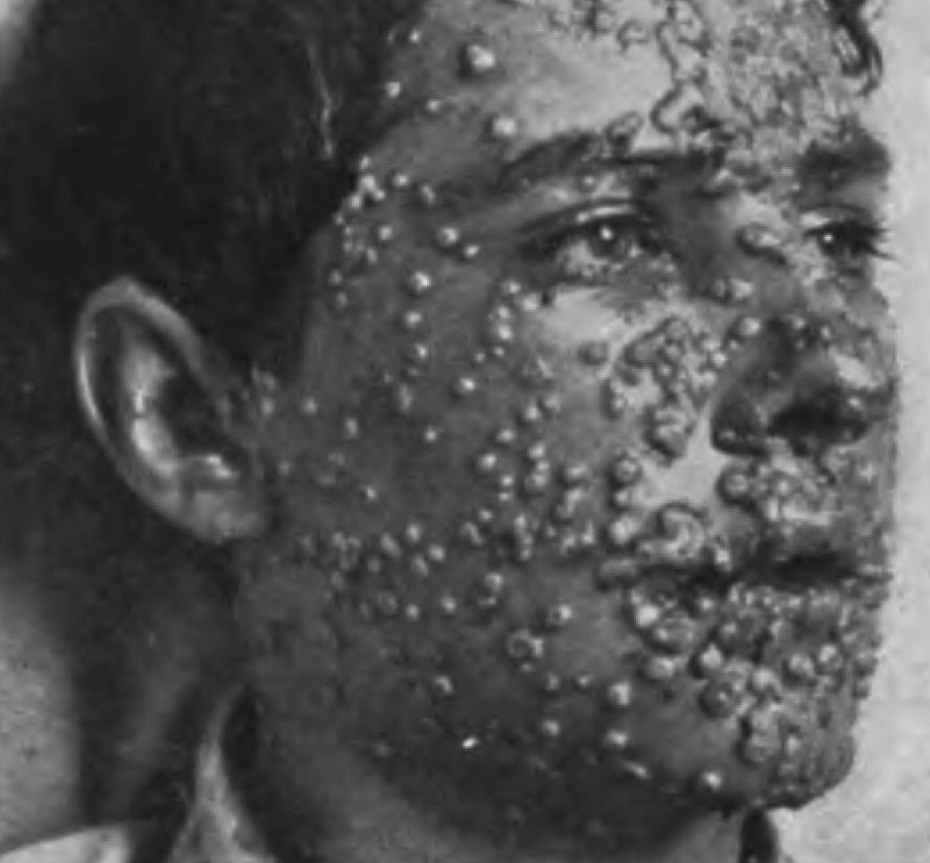 Operation Dark Winter, Simulasi Bencana Virus Amrik.