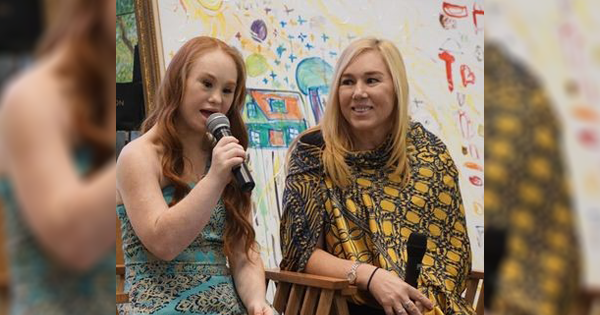 Madeline Stuart, Model Down Syndrome Pertama yang Mendunia!