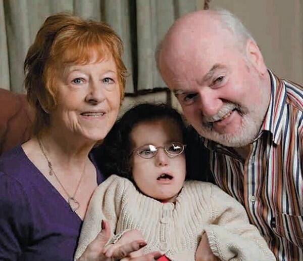 Yuk Mengenal 4 Macam Kelainan Trisomi, Down Syndrome Itu Salah Satunya