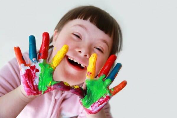 Yuk Mengenal 4 Macam Kelainan Trisomi, Down Syndrome Itu Salah Satunya