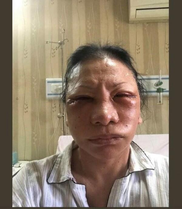 Ratna Sarumpaet Bantah Saksi yang Mengaku Dikirim Foto Lebam