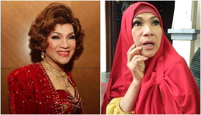 5 Artis Transgender yang Dulu Tampan Sekarang Cantiknya Kebangetan!