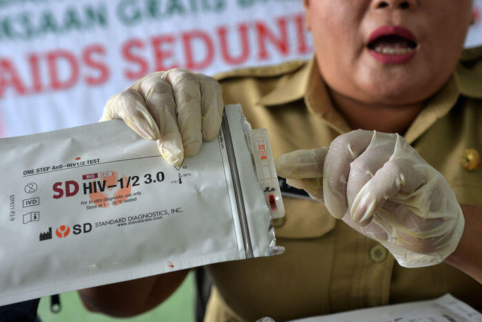 Terapi baru untuk membunuh HIV