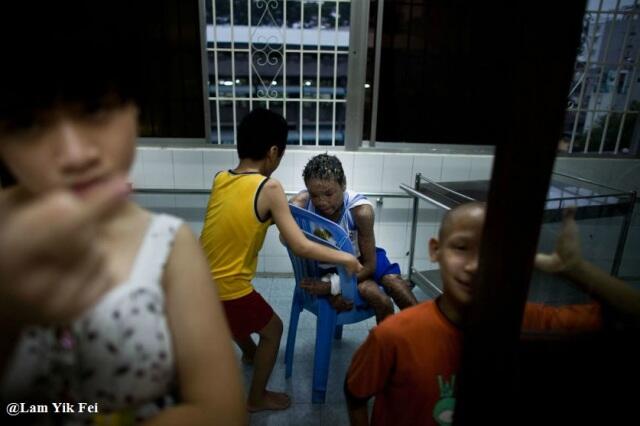 Foto Anak-Anak Korban Agent Orange Di Vietnam